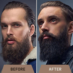 Partaöljy - Santelipuu